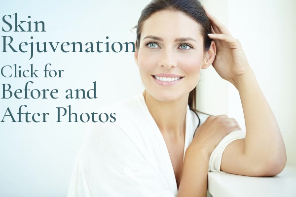 J Barton Sterling - Skin Rejuvenation Before & After