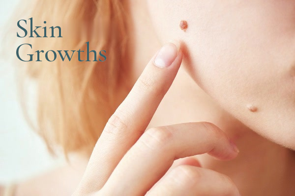 J Barton Sterling - Skin growths